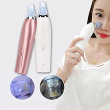 Electric Acne Remover